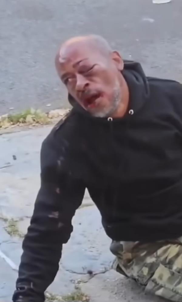 A screenshot from the video showing Buckshot on the ground after the attack.