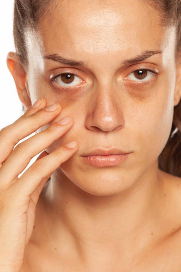A salty diet, lack of sleep, allergies, smoking, genetics, hormo<em></em>nal changes, and certain medical co<em></em>nditions such as the inflammatory disease dermatomyositis may also be to blame for the puffiness.