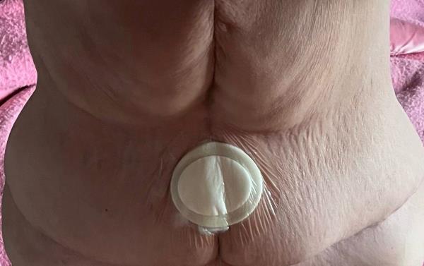 The cash-strapped mama couldn't afford to have the procedure done in her home country as the cost would have totaled close to $34,000 USD. 