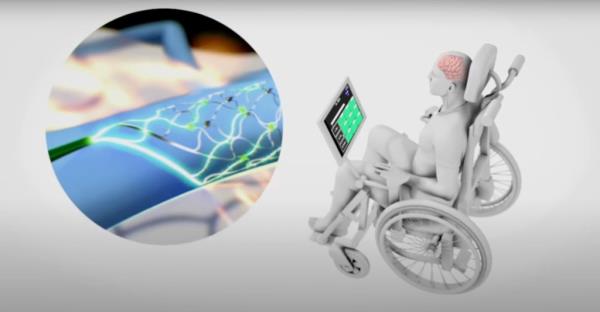 The implant allows Mark to “wirelessly transmit motor intent” from his brain to “perso<em></em>nal devices with hands-free point-and-click.”